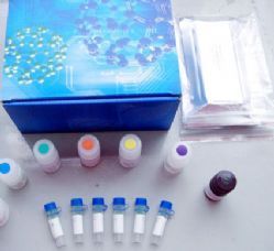 人免疫球蛋白輕鏈lambda（λ-IgLC）ELISA Kit 產(chǎn)品說明與價格解析